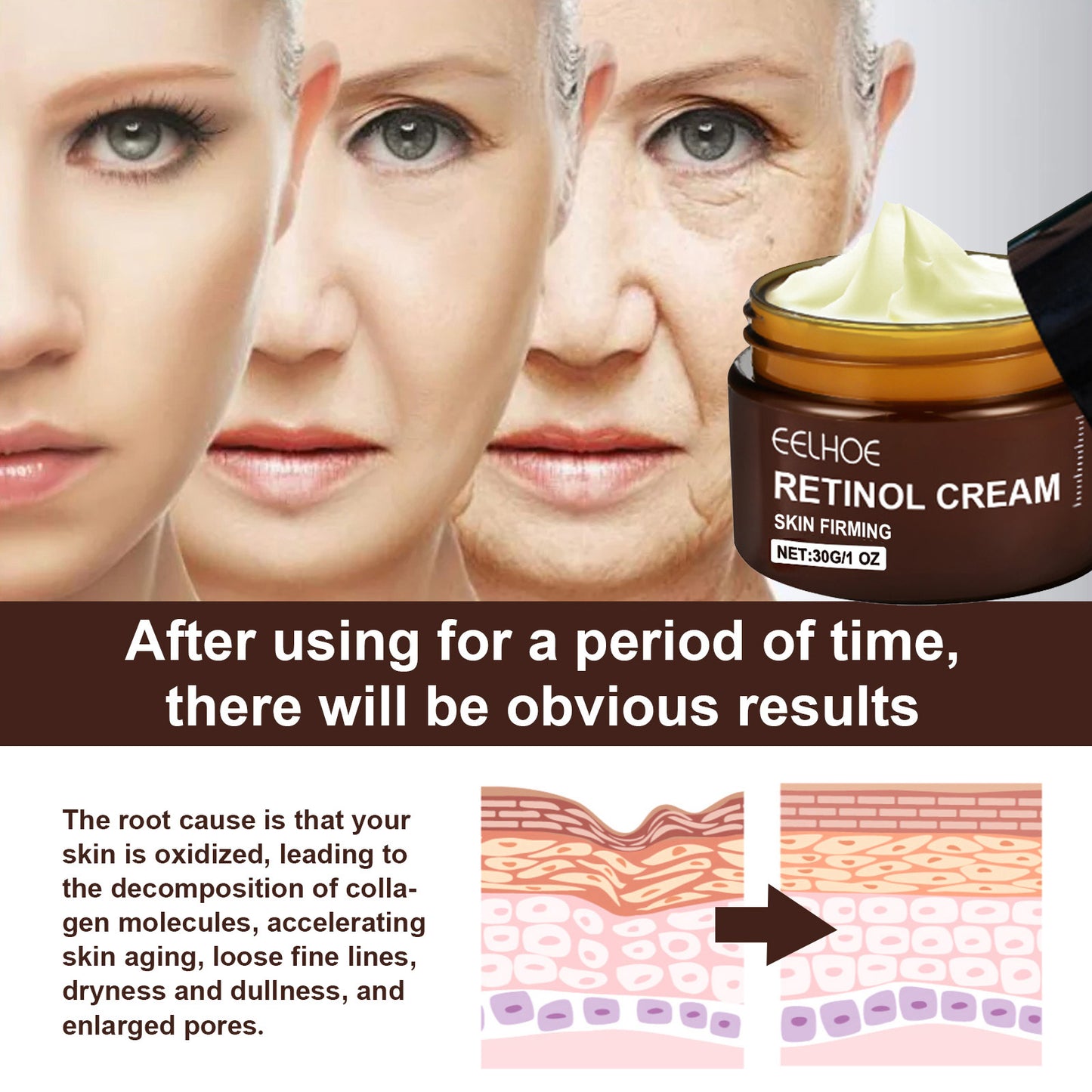 USA ONLY: EELHOE Retinol Cream, Anti-Aging Firming Brightening Moisturizing Facial Skin Care Cream- Buy 2 get 1 Free