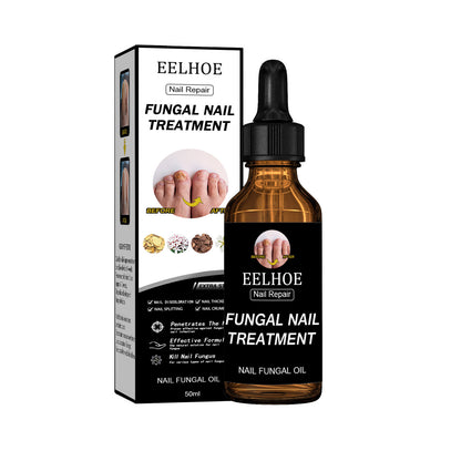 USA ONLY: EELHOE Nail Repair Solution, Thickening And Brightening Nails Removing Gray Nail Repair Nourishing Nail Care Solution